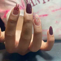 کاشت ،ژلیش ،لمینت