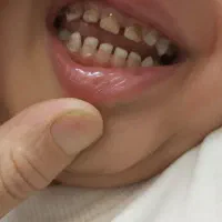 دندونتو با تخفیف ۵۰درصد و اقساطی درست کن