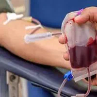 حجامت وفصد خون درمنزل در قرچک پذیرفته میشود
