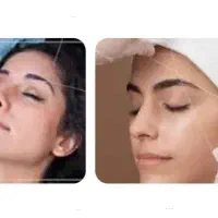 اصلاح صورت باقیمت مقطوع