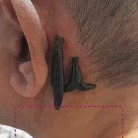 خدمات ماساژ و حجامت تخصصی سیار