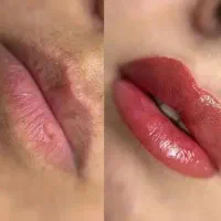 پذیرش مدل با قیمت فوق العاده و ویژه