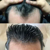 دیگه غصه موهاتو نخور