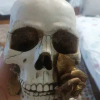 مجسمه استخوان سر