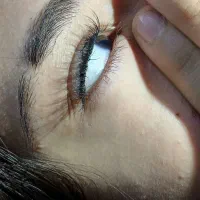 خدمات کاشت و لیفت و لمنیت