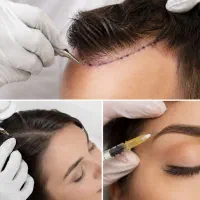 آموزش تخصصی کاشت،مزوتراپی و پی آر پی و کاتری