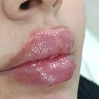 کلینیک زیبایی تزریق ژل و بوتاکس