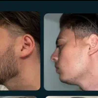 یه ریش خفن می‌تونه کل قیافتو عوض کنه