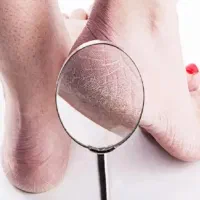 آموزش و خدمات تخصصی پدیکور درمانی و سالنی