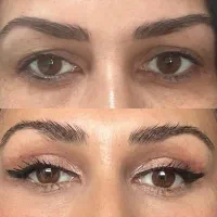 جراحی بینی لیفت شقیقه بلفاروپلاستی کلینیک زیبایی