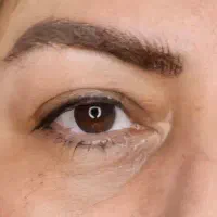 اکسشتن مژه وکاشت هیدن