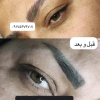 ریموو تاتو ابرو چشم لب