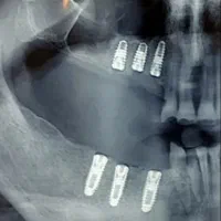 آفر ویژه مطب دندان پزشکی