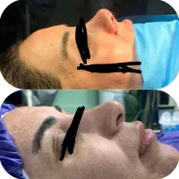 مشاوره عمل های زیبایی
