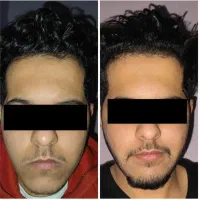 بازگشت اعتماد به نفس تضمینی