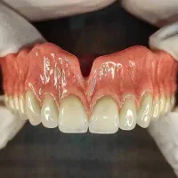 کلینیک دندانسازی و دندانپزشکی مروارید