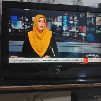 تلویزیون اکس ویزن