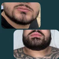 تمام مشکلات پوست و مو  وریش تون رو به ما بسپارید