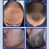 چسب ریش|آرایشی، بهداشتی، درمانی|سنندج, |دیوار