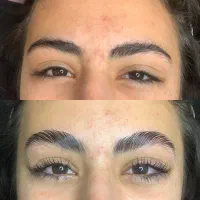 لیفت ابرو‌ لیفت مژه تخصصی