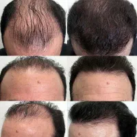 موهاتو سیرش کن دربیاد