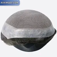 پروتز مو کاشت مو|خدمات آرایشگری و زیبایی|محمودآباد, |دیوار