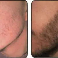 وقتش رسیده دیگه سایه بندازی