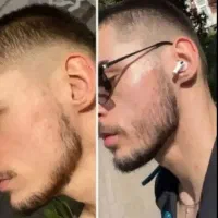 راهکار ساده برای داشتن ریشهای جذاب و پر