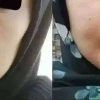 چاقی صورت