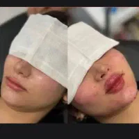 تزریق ژل بوتاکس پرسینگ