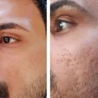 کرم بیوممتیک ۱۵کاره اصل/ضدلک لیفت کننده