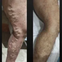 کلینیک تخصصی واریس