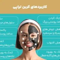 کربن تراپی و وایتنینگ صورت تخفیف جشنواره