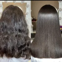 پروتیین تراپی ،بوتاکس،پروبوتاکس،اولاپلکس