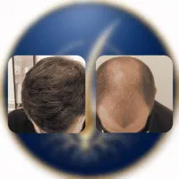 ۱۹ روزه|آرایشی، بهداشتی، درمانی|یزد, |دیوار