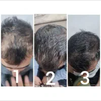 پاکسازی ومراقبت های پوستی