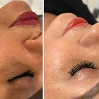 پاکسازی تخصصی پوست ویژه بانوان