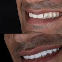 دیگربه بیمه دندانپزشکی نیازی نیست