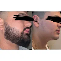 ریش هدیه خدا به مردهاست ولی