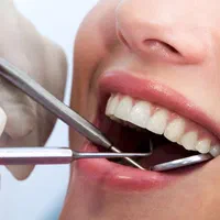 آفر ویژه عصب کشی و پر کردن دندانپزشکی شکوفه(اقساط)