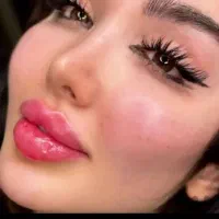 فیلر.ژل لب.طراحی و لیفت لب روسی توسط متخصص
