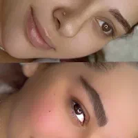 نانوبلیدینگ استایل لیفت شقیقه