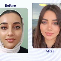 عمل بینی با شرایط ویژه (مشاوره رایگان)