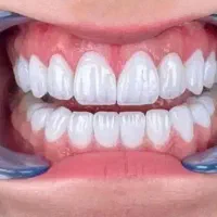 دندانپزشکی لبخند مهر