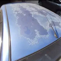 رفع آفتاب سوختگی تخصصی