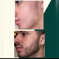 تا کی بدون ریش میخوای بمونی
