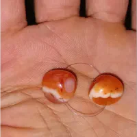 سه جفت مهره سلیمانی