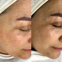 پاکسازی درمانی و جوانسازی