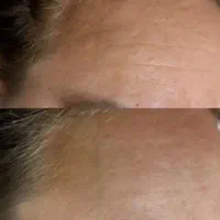 کرم معجزه‌آور بیوممتیک گاتیو تحویل یک‌روزه