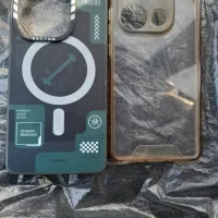 قاب شیایومی نوت ۱۴